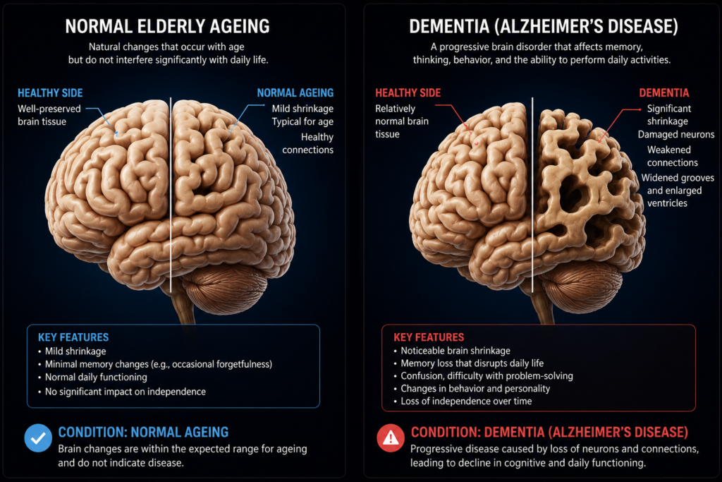 Difference between dementia and normal aging in elderly